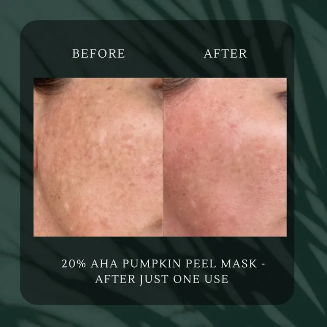 20% AHA Exfoliating Pumpkin Enzyme Peel Mask